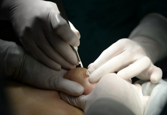 Sau khi thăm khám, các bác sỹ đã xác định cô bị vỡ túi độn ngực và dung dịch bị tràn ra ngoài.