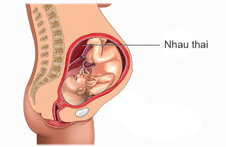 Vấn đề ở nhau thai: Nếu nhau thai không cung cấp đủ máu và chất dinh dưỡng cho bé thì bé sẽ giảm khả năng bài tiết nước tiểu và gây thiểu ối.