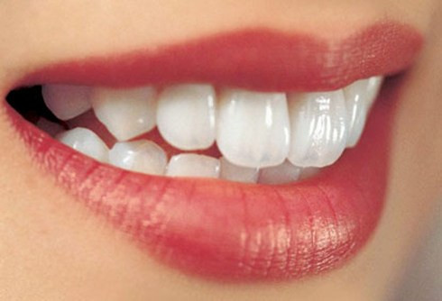 Than. Than là một trong những biện pháp khắc phục tốt nhất cho răng vàng xỉn màu. Than có một loại hóa chất với tinh thể làm trắng mạnh mẽ giúp tẩy trắng răng cho bạn. Hãy lấy một chút bột than và trộn nó với kem đánh răng của bạn rồi nhẹ nhàng đánh răng. Thực hiện hai lần mỗi ngày để răng của bạn trắng bóng rạng ngời.