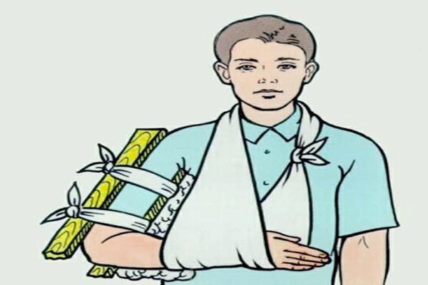 Không di chuyển mạnh. Hãy tự mình bất động tay, chân bị cắn bằng nẹp và đừng cử động. Bởi bạn cử động nhiều, nọc độc sẽ xâm nhập cơ thể và lây lan rất nhanh, rất nguy hiểm. Nếu có đồ trang sức ở chân tay, hãy cởi bỏ vì nó có thể gây chèn ép khiến vùng bị cắn sưng nề.