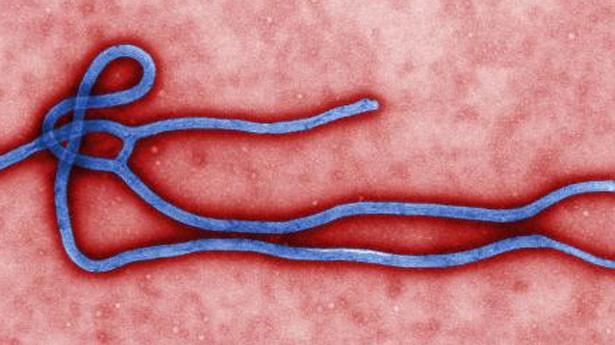 Dịch Ebola năm 1979, xảy ra ở Nzara, Maridi, thời điểm dịch này có khoảng 34 người bị lây nhiễm, trong đó có 24 trường hợp tử vong.