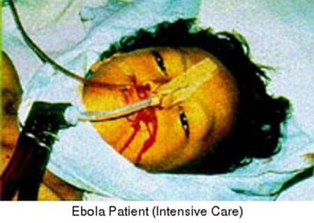 Dịch Ebola năm 1995. Năm 1995, tại Cộng hòa Dân chủ Congo cũng đã xảy ra một trận dịch Ebola làm hơn 200 người thiệt mạng. Nơi xảy ra dịch là ở Kikwit, cách nơi xảy ra trận dịch năm 2014 khoảng 400km về phía Tây.