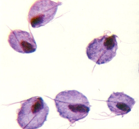 Trùng roi là một loại ký sinh trùng có tên Trichomonas Vaginalis, mắt thường không nhìn thấy được. Chúng sống ký sinh ở âm đạo, dịch tiết âm đạo, các nếp nhăn của da ở bộ phận sinh dục, gây nên các triệu chứng viêm nhiễm.