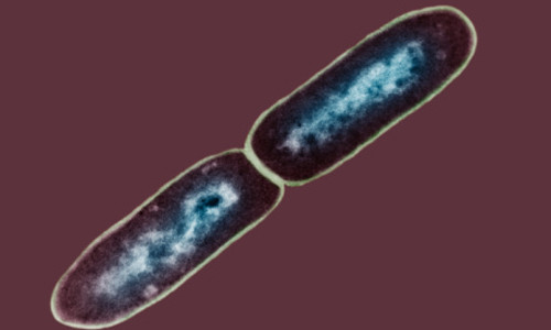 Hạ cam mềm là bệnh do loại vi khuẩn hình que có tên là Hemophilus Ducryi gây ra. Đây là bệnh lây truyền qua đường tình dục, ảnh hưởng đến sức khỏe sinh sản và chất lượng sống của người mang bệnh.