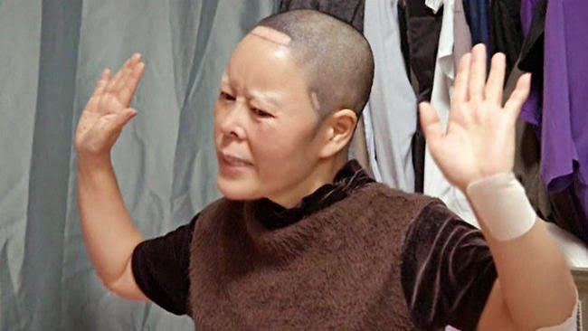 Cô đã trải qua 15 ca phẫu thuật trên mặt chỉ trong vòng... một ngày.