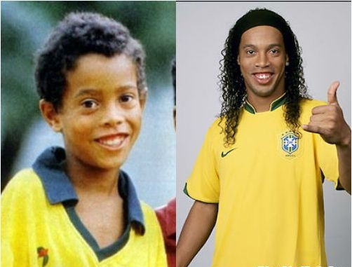 Chiếc răng thỏ là đặc điểm dễ nhận ra nhất của Ronaldinho (Brazil). Ngay từ khi còn bé, Rô "vẩu" đã rất duyên với hai chiếc răng này của mình.