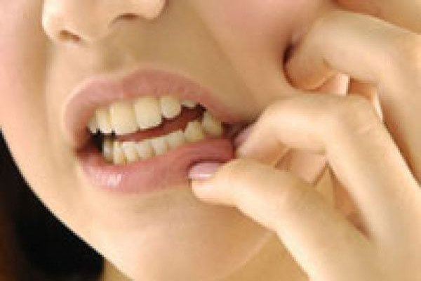 Đau răng mỗi sớm mai thức dậy. Có lẽ bạn đã nghiến răng quá nhiều trong lúc ngủ. Nghiến răng lúc ngủ có thể gây ra các biến chứng về dây thần kinh khiến cho bạn căng thẳng mệt mỏi.