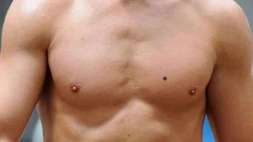 Trên ngực. Trên ngực có nốt ruồi thì đào hoa, bất kể là nam hay nữ đều dễ dàng thu hút người khác giới, nhưng đồng thời cũng dễ suy sụp vì tình yêu, họ còn dễ gặp phải thị phi vì chuyện tình cảm.