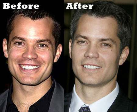 Nam diễn viên Timothy Olyphant đã tân trang lại khuôn mặt đẹp hơn lên rất nhiều, khiến cho cười duyên cũng duyên.