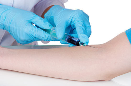 Tầm soát HPV. Virus HPV mặc dù không gây dị tật bẩm sinh thai nhi nhưng lại liên quan đến khả năng tăng nguy cơ sinh non khi mà não và phổi của thai nhi chưa phát triển hoàn thiện, và hậu quả là trẻ sinh ra có thể bị suy não và phổi nghiêm trọng. Ước đoán có đến 50% đàn ông và phụ nữ có sinh hoạt tình dục đều từng bị nhiễm HPV sinh dục ở một thời điểm nào đó trong đời.