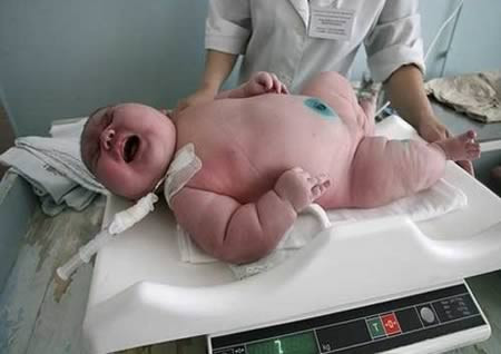 Ademilton dos Santos chào đời ngày 19/1/2005 nặng 7,7 kg và trở thành em bé nặng nhất Brazil từ trước tới nay. Bốn người con trước đó của cô Francisca Ramos dos Santos đều có trọng lượng bình thường. Các bác sĩ tin rằng, mẹ bé Ademilton dos Santos bị tiểu đường khi mang thai.
