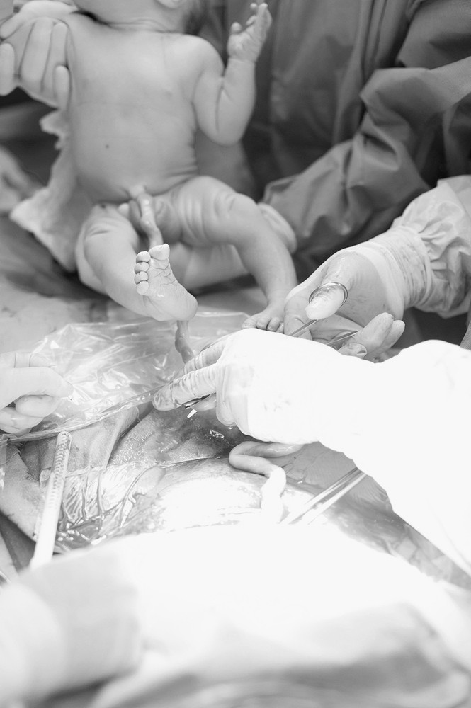 Các bác sĩ đang tiến hành cắt rốn cho e bé mới sinh.
