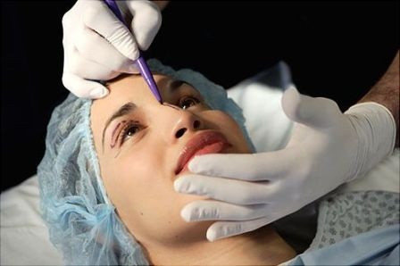 Nâng mũi Radies là một trong những kỹ thuật nâng mũi không dao kéo được các chuyên gia thẩm mỹ rất tín nhiệm. Phương pháp này không bóc tách, không xâm lấn nên không tạo cảm giác đau đớn hay áp lực tâm lý cho khách hàng.