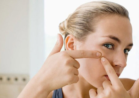 Chỉ có thể “giải quyết” bằng cách nặn. Nặn mụn, hút mụn.... chỉ có thể làm cho bạn “an tâm” được vài ngày, bởi vì những biện pháp đó đều là tạm thời, không bao lâu sau thì mụn lại “nổi” lên ở ngay chỗ cũ bạn vừa nặn. Nặn mụn sẽ làm cho chúng nhiễm trùng, lây lan và thậm chí để lại sẹo.