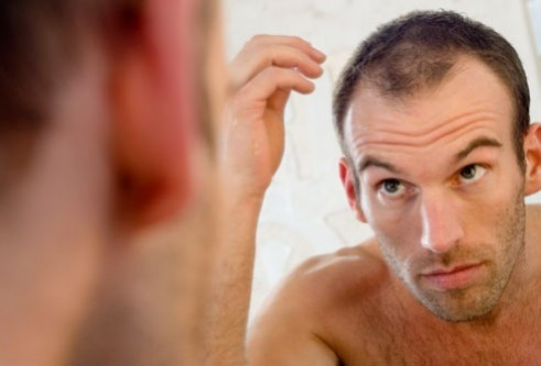 Không để ý đến mái tóc mỏng. Hói đầu là tình trạng phổ biến ở nam giới và chỉ số ít đàn ông may mắn không phải đối mặt với tình trạng này. Tóc thưa thường bắt đầu từ những năm độ tuổi 20 và việc rụng tóc cứ tăng đều 4% mỗi năm. Chọn lựa một kiểu tóc phù hợp cũng làm giảm thiểu tối đa những vùng bị thưa tóc, nhưng không hoàn toàn loại bỏ tình trạng này.