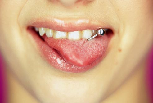 Khuyên lưỡi có thể là xu hướng thời trang hợp thời của giới trẻ, nhưng khi nhai thức ăn, kim loại này có thể vập vào răng, gây tổn thương nướu răng, sứt răng, tăng nguy cơ nhiễm trùng răng miệng.