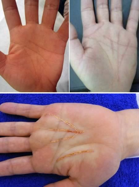 Phẫu thuật chỉ tay. Người Nhật cho rằng chỉ tay chính là biểu hiện cuộc đời tương lai của họ. Mong muốn có một tương lai tươi đẹp và để thay đổi số phận của mình, nhiều người Nhật Bản đã tiến hành phẫu thuật chỉ tay. Ca phẫu thuật này sẽ chỉ diễn ra trong vòng 15 phút với chi phí khoảng 1.100 USD.
