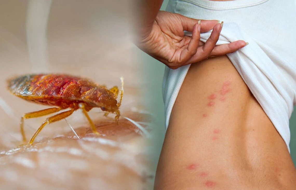 Sẽ ra sao nếu rệp giường có kích cỡ bằng con người?