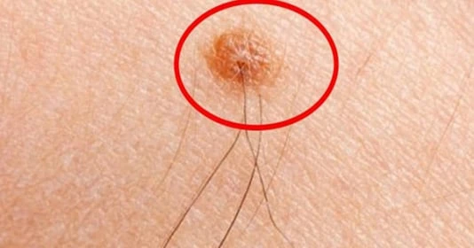 Cổ nhân dạy: Người có lông mọc nhiều ở 4 vị trí này rất giàu