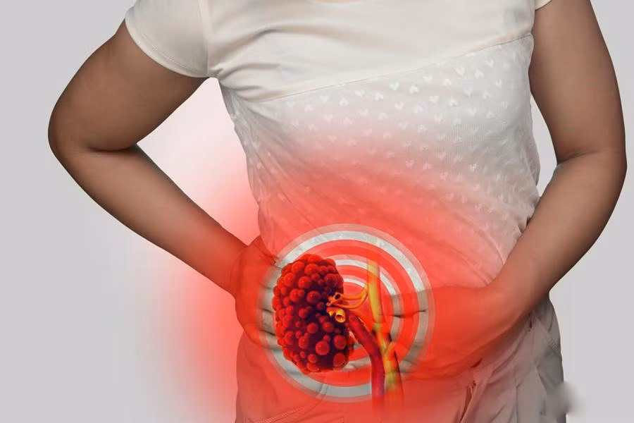 Dấu hiệu và triệu chứng cảnh báo sỏi thận mà rất nhiều người mắc phải Dau hieu va trieu chung canh bao soi than ma rat nhieu nguoi mac phai