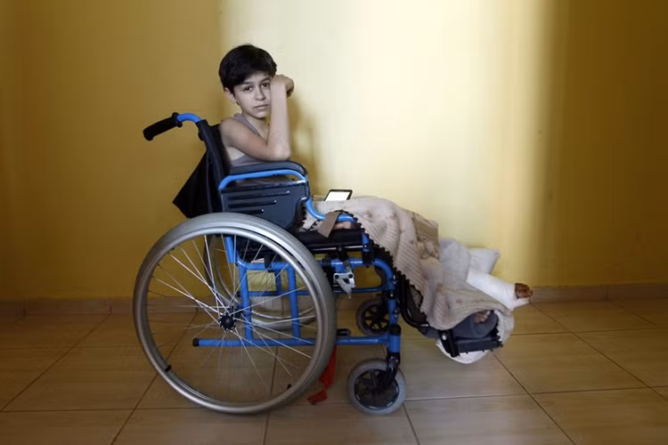 Cậu bé Mohammad, 11 tuổi, ở một trại tị nạn bên trong lãnh thổ Thổ Nhĩ Kỳ. Thổ Nhĩ Kỳ hiện có hơn 300.000 người tị nạn Syria.