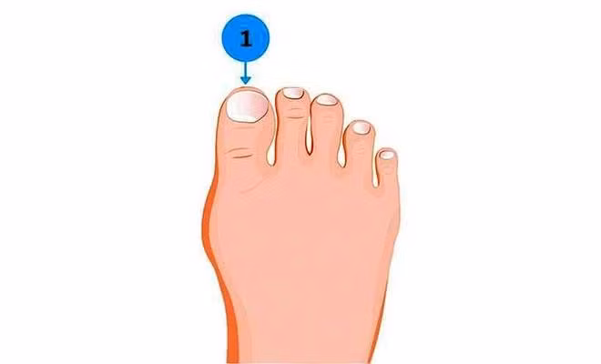  Tướng ngón chân cái to: Trong nhân tướng học người có tướng bàn chân to với ngón chân cái to là người cương trực luôn giữ uy tín. Chính vì vậy, những người này khi đã đặt ra mục tiêu là sẽ cố gắng hết mình trên con đường đã lựa chọn. Đặc biệt những người này rất may mắn trên con đường công danh sự nghiệp số mệnh giàu sang. 