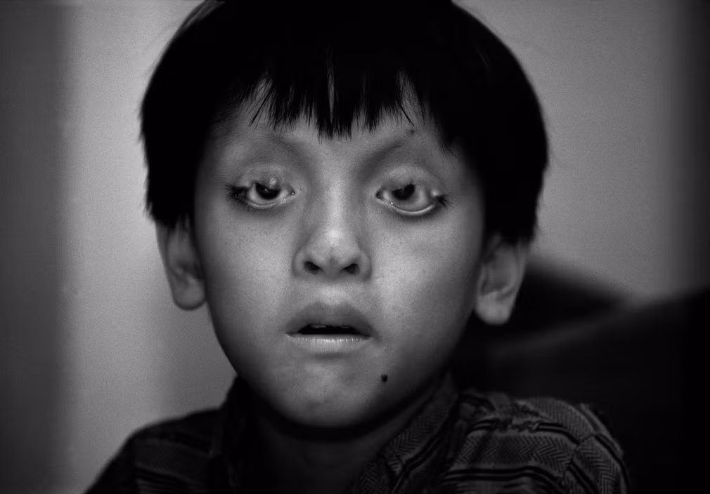 Hinh anh khung khiep ve “noi dau da cam” thap nien 1990 (1)