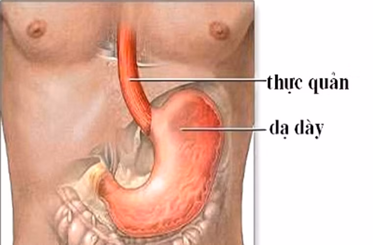 Thực tế, bệnh thường được phát hiện muộn khi đã chuyển sang giai đoạn cuối khiến khó lòng cứu vãn. Căn nguyên của vấn đề trên bắt nguồn từ yếu tố ung thư ít có dấu hiệu đặc trưng, dễ nhầm lẫn với những triệu chứng thông thường khác ở thực quản.