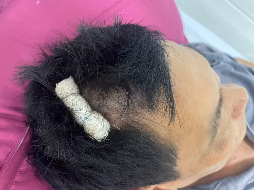 Cán bộ xã dùng cốc đập vào đầu người dân trong quán nhậu - Hình 2 Can bo xa dung coc dap vao dau nguoi dan trong quan nhau-Hinh-2