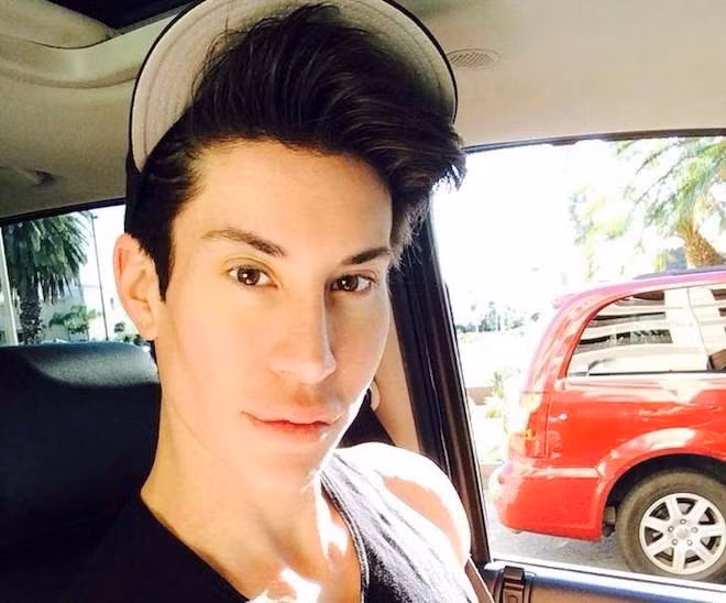 Chàng trai phẫu thuật 140 lần để giống búp bê. Justin Jedlica, 33 tuổi, người Mỹ đã trải qua hơn 100 cuộc phẫu thuật và ước tính đã bỏ ra khoảng 165.000 USD (hơn 3,4 tỷ đồng) cho các lần phẫu thuật.