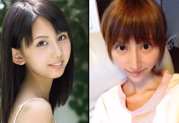 Rina Nanase, một hot girl, diễn viên có tiếng tại Nhật Bản gây sốc khi tung ra loạt hình ảnh khuôn mặt bị biến dạng sau nhiều ca "dao kéo".