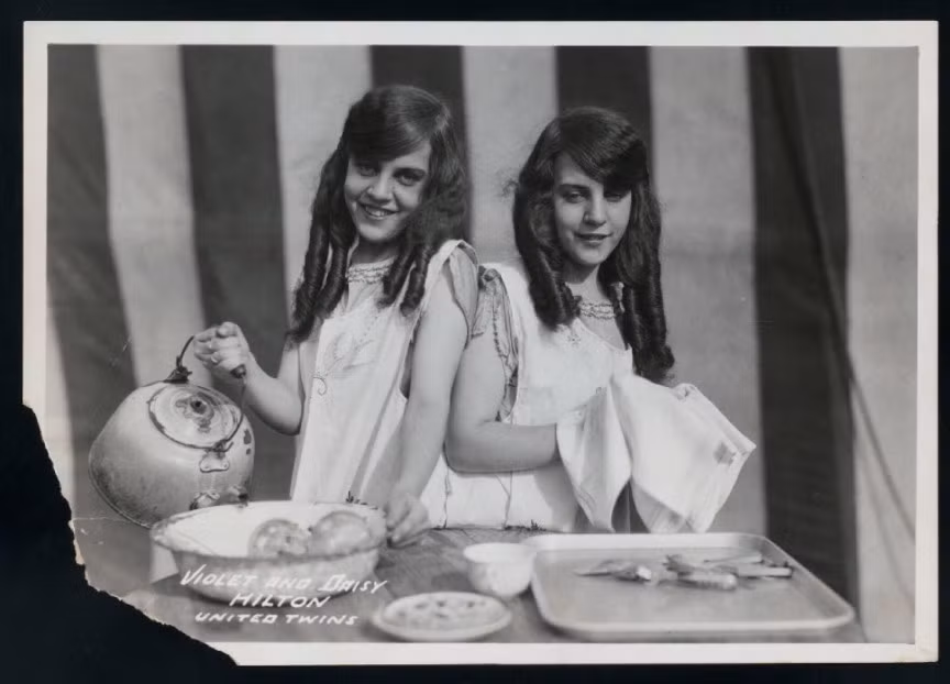 Daisy và Violet sinh ra vào năm 1908 tại Bringhton, nước Anh bởi cô bồi bàn Kate Skinner. Họ sống từ năm 1908 cho đến năm 1969. Sinh ra với phần dính liền xương chậu và hông, cặp song sinh này đã kiếm được bội tiền nhờ tài năng biểu diễn clarinet, saxophone, hát và nhảy múa. Đến năm 1969, cặp song sinh này đã qua đời do bị cúm.