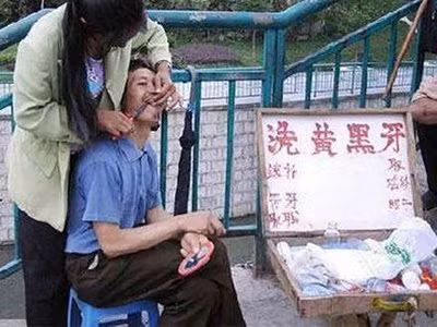 Nhổ răng thời "Trung Cổ"?
