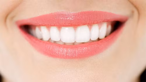 Từ trước đến nay, sở hữu một hàm răng trắng đều luôn là chìa khóa then chốt cho một gương mặt rạng ngời xinh đẹp.Tuy nhiên, chăm sóc răng miệng không phải là chuyện một sớm một chiều. Làm răng đòi hỏi nhiều thời gian hơn, nhiều tiền bạc hơn và thậm chí là cả đau đớn.