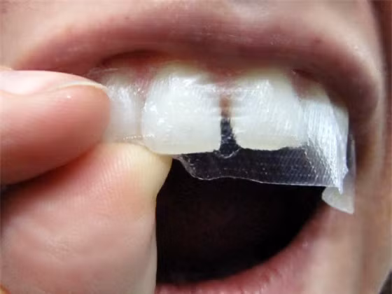 Miếng dán làm trắng răng có dạng trong suốt như băng dính, trong đó có chứa sẵn hoạt chất làm trắng hydrogen peroxide (liều lượng tùy thuộc vào các thương hiệu khác nhau).