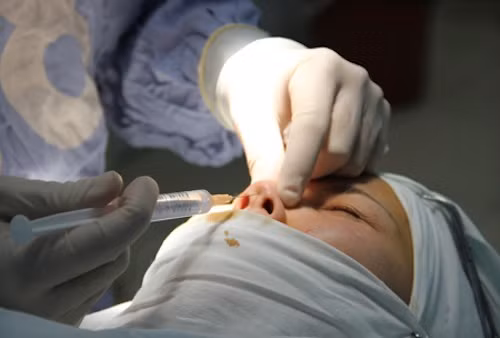 Bước 1: Khi Lê Quyên nâng mũi, cô cũng phải bắt đầu từ bước nhận tư vấn của các chuyên gia về kích cỡ, chiều cao cần nâng với mũi của bạn. Không phải cứ nâng mũi thật cao lên sẽ đẹp, điều này còn tùy thuộc vào tổng thể gương mặt bạn có hài hòa với chiếc mũi bạn mong muốn không. Từ đó, các chuyên gia sẽ cho bạn những lời khuyên đúng đắn. 