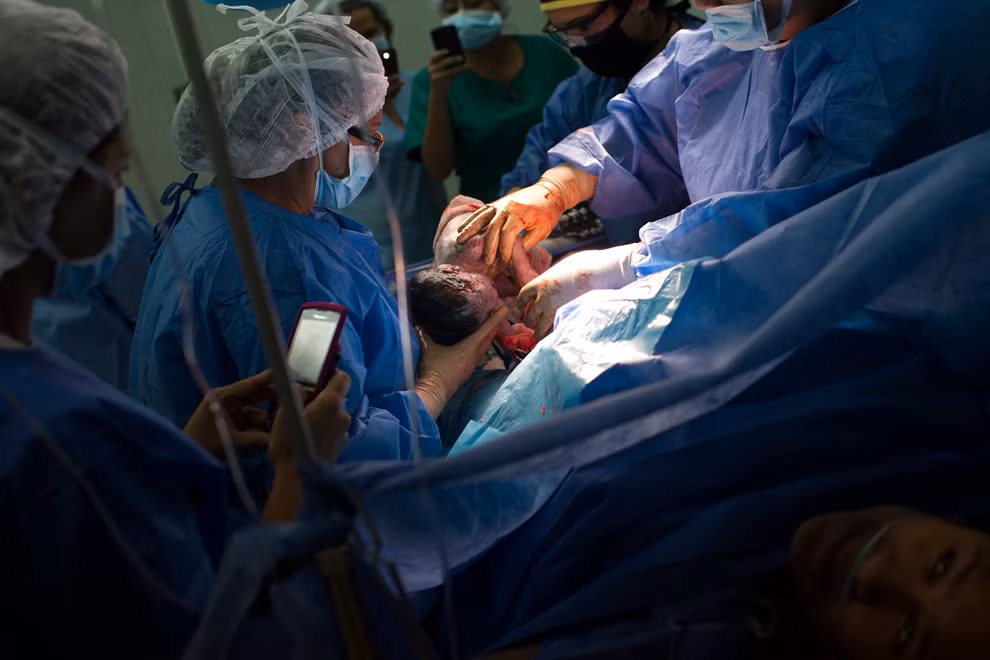 Bác sĩ đang bế một trong ba em bé sơ sinh trong ca sinh ba của cô Yojaimi Garcia, 20 tuổi, trong lúc cô đang trải qua ca sinh mổ tại bệnh viện phụ sản công cộng Santa Ana ở Caracas.