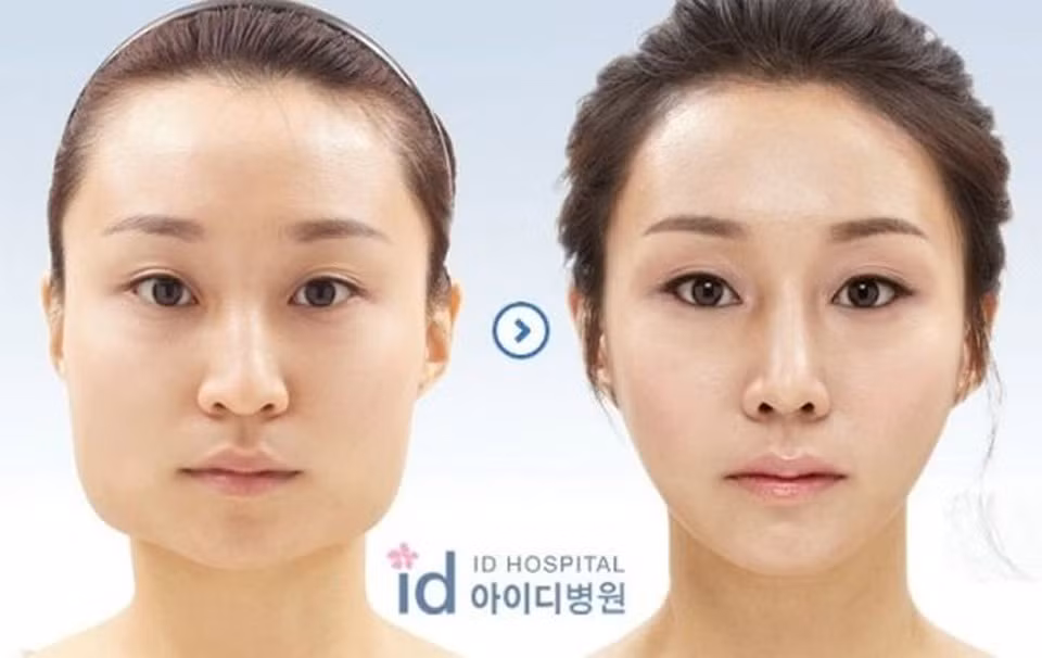 Rất nhiều bức ảnh trước và sau phẫu thuật đã từng được công bố khiến nhiều người không khỏi ngạc nhiên trước sức mạnh của công nghệ dao kéo.