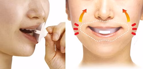 Miếng nâng cơ hàm. Mỗi ngày 3 lần, bạn đặt dụng cụ làm đẹp từ nhựa dẻo này vào miệng. Chúng sẽ khiến nâng cơ mặt của bạn ngay từ bên trong. Sẽ có chút khó chịu khi sử dụng song sản phẩm đang nhận được nhiều phản hồi tích cực.