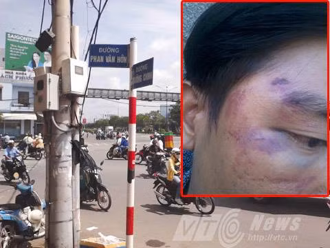 Vết thương của anh Sỹ