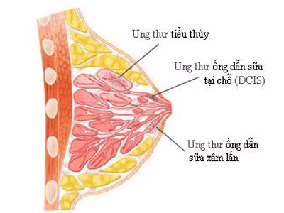 Nghiên cứu đang được tiến hành để xác định cách mô hình giấc ngủ tự nhiên có thể tác động đến sự sản xuất melatonin và thúc đẩy tăng trưởng khối u.