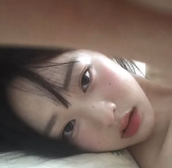 Ung thư rất dễ “ngụy trang” dưới hình dạng của 4 loại mụn này Ung thu rat de “nguy trang” duoi hinh dang cua 4 loai mun nay