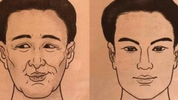  3. Tướng thiên thương sáng. Trên khuôn mặt, thiên thương nằm ở vị trí đuôi lông mày và đuôi mắt. Tướng thiên thương tốt là phải dày mà bằng, khí sắc hồng hào, không khuyết hãm.
