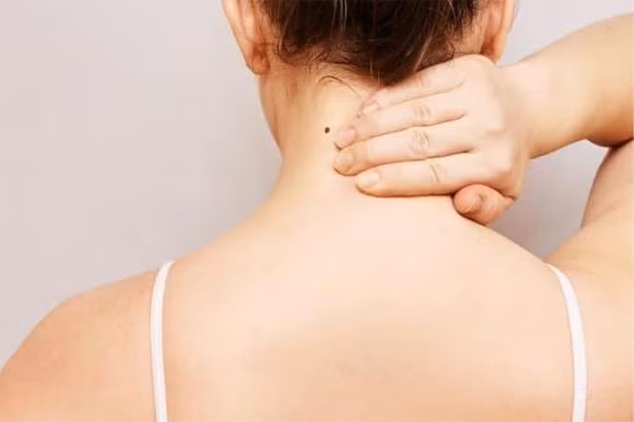  Nốt ruồi phía sau gáy nhưng lệch về 2 bên: Người có nốt ruồi ở vị trí này thường gặp vấn đề trong chuyện tình cảm, có thể là dối tình người khác hoặc bị người khác lừa gạt. Nốt ruồi ở vị trí này có nhiều tiền đến đâu cũng không thể xóa đi được, nếu không chuyện hôn nhân cả đời cũng sẽ không thuận. 