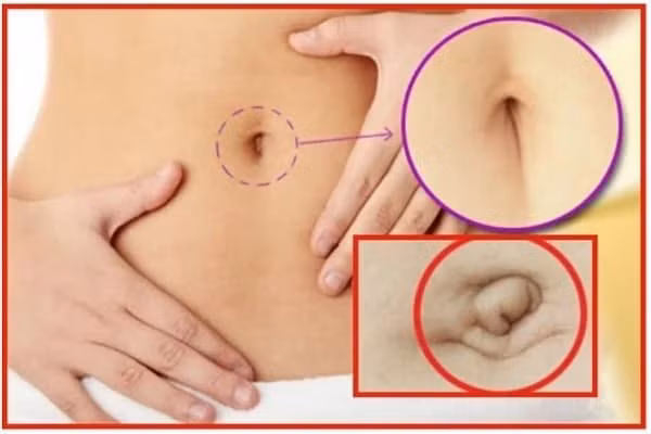 Người vượng tướng, vận số tốt thường sở hữu 3 kiểu rốn này Nguoi vuong tuong, van so tot thuong so huu 3 kieu ron nay