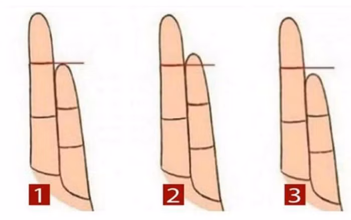 Dù vậy, người sở hữu ngón út thế này đôi lúc lại bảo thủ và họ luôn hướng đến một cuộc sống ổn định. Hậu vận khi về già của họ có thể đồng hành cùng người bạn đời của mình. Người này phù hợp với những ngành nghề ít biến động. 