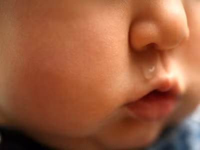 ...chảy nước mũi. Bệnh này hay lây đến nỗi 90% những người tiếp xúc với bệnh nhân sẽ bị lây sởi nếu chưa chích ngừa. Siêu vi sởi có ở mũi và cổ họng của bệnh nhân. Virus sởi xâm nhập vào cơ thể qua đường hô hấp. Tại đây, virus nhân lên ở tế bào biểu mô của đường hô hấp và ở các hạch bạch huyết lân cận. Sau đó, virus vào máu (nhiễm virus máu lần thứ nhất). Thời kì này tương ứng với thời kì ủ bệnh.