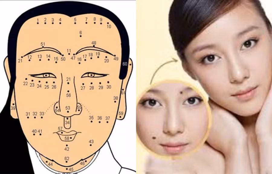 10 nốt ruồi phá tướng ai dính phải nghèo khổ cả đời - Hình 2 10 not ruoi pha tuong ai dinh phai ngheo kho ca doi-Hinh-2