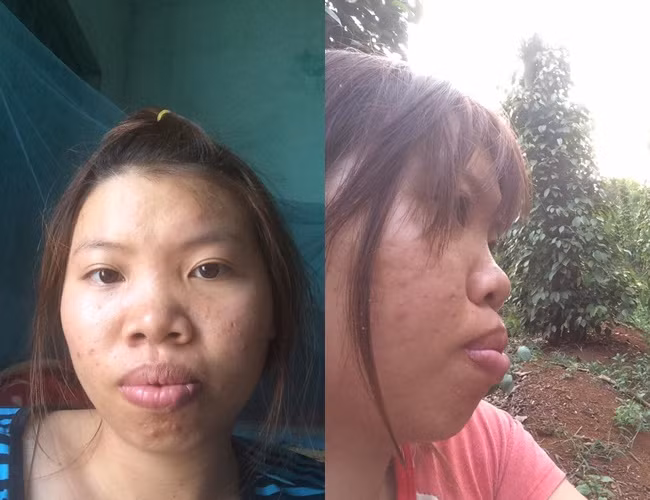 Co gai tung bi chong bo vi xau nhu Thi No
