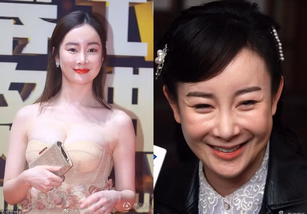 Bi kich nhung nguoi dep noi tieng phau thuat tham my hong-Hinh-2